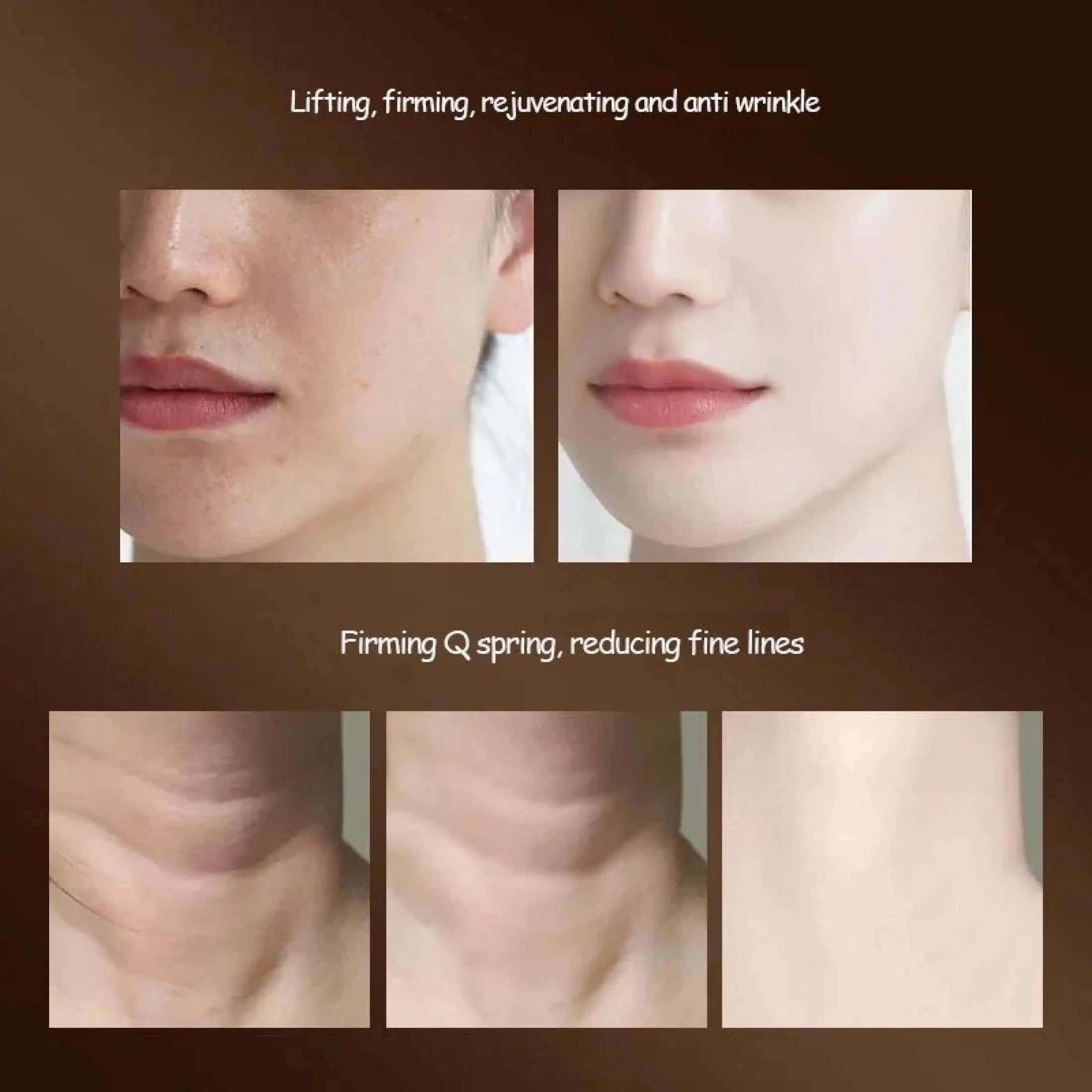 VivaTone™ Face & Neck Rejuvenator