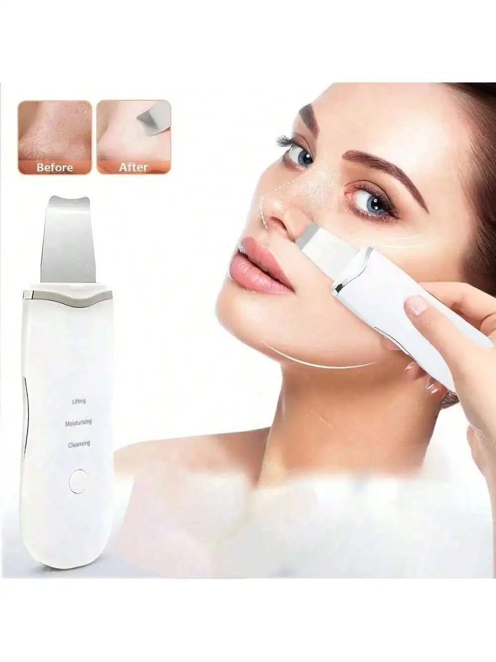 Ultrasonic Facial Scrubber