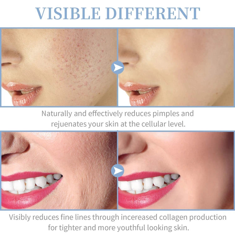 High Frequency Skin Therapy Wand