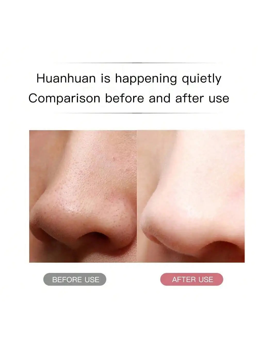Ultrasonic Facial Scrubber