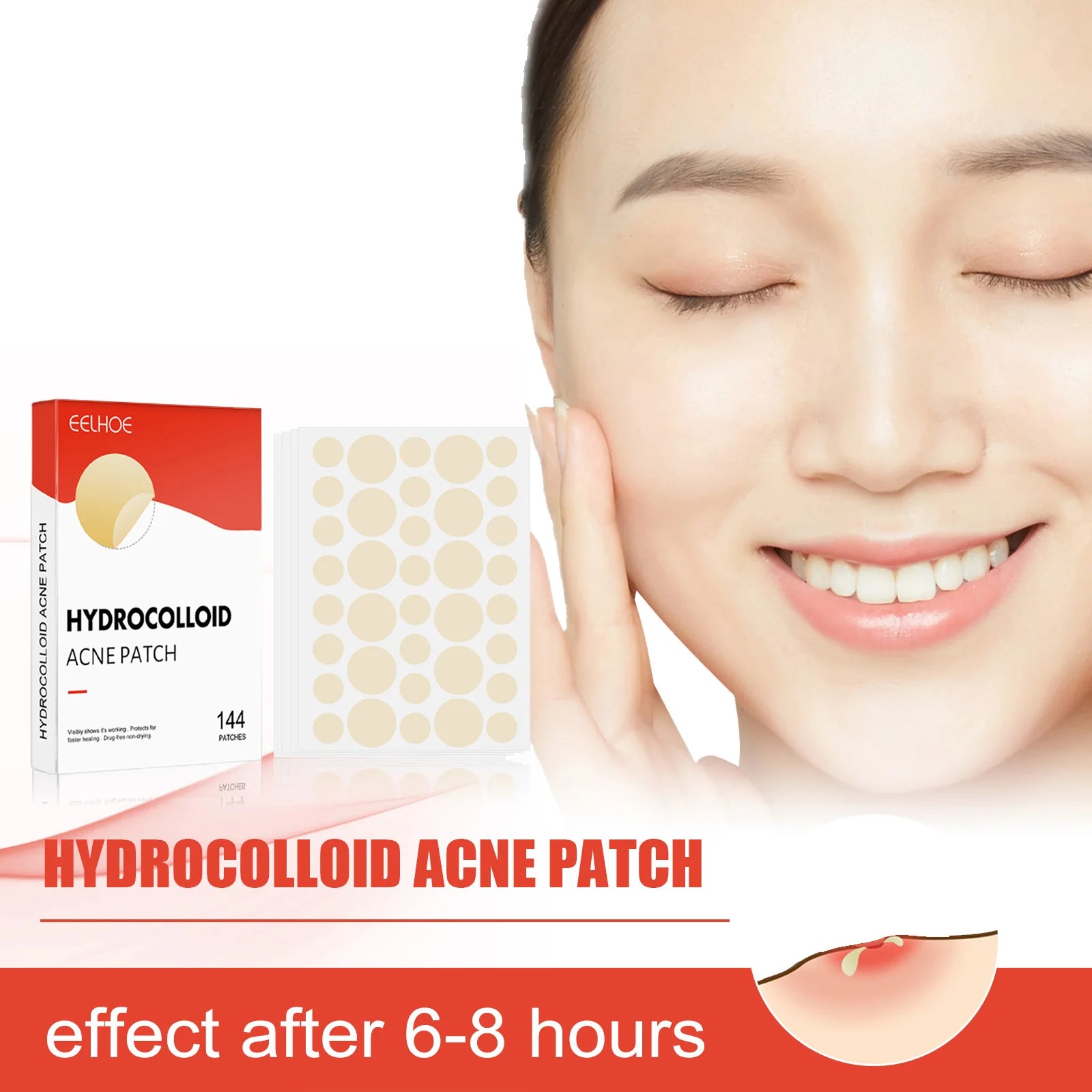Hydrocolloid Acne Patches – 2 Sizes