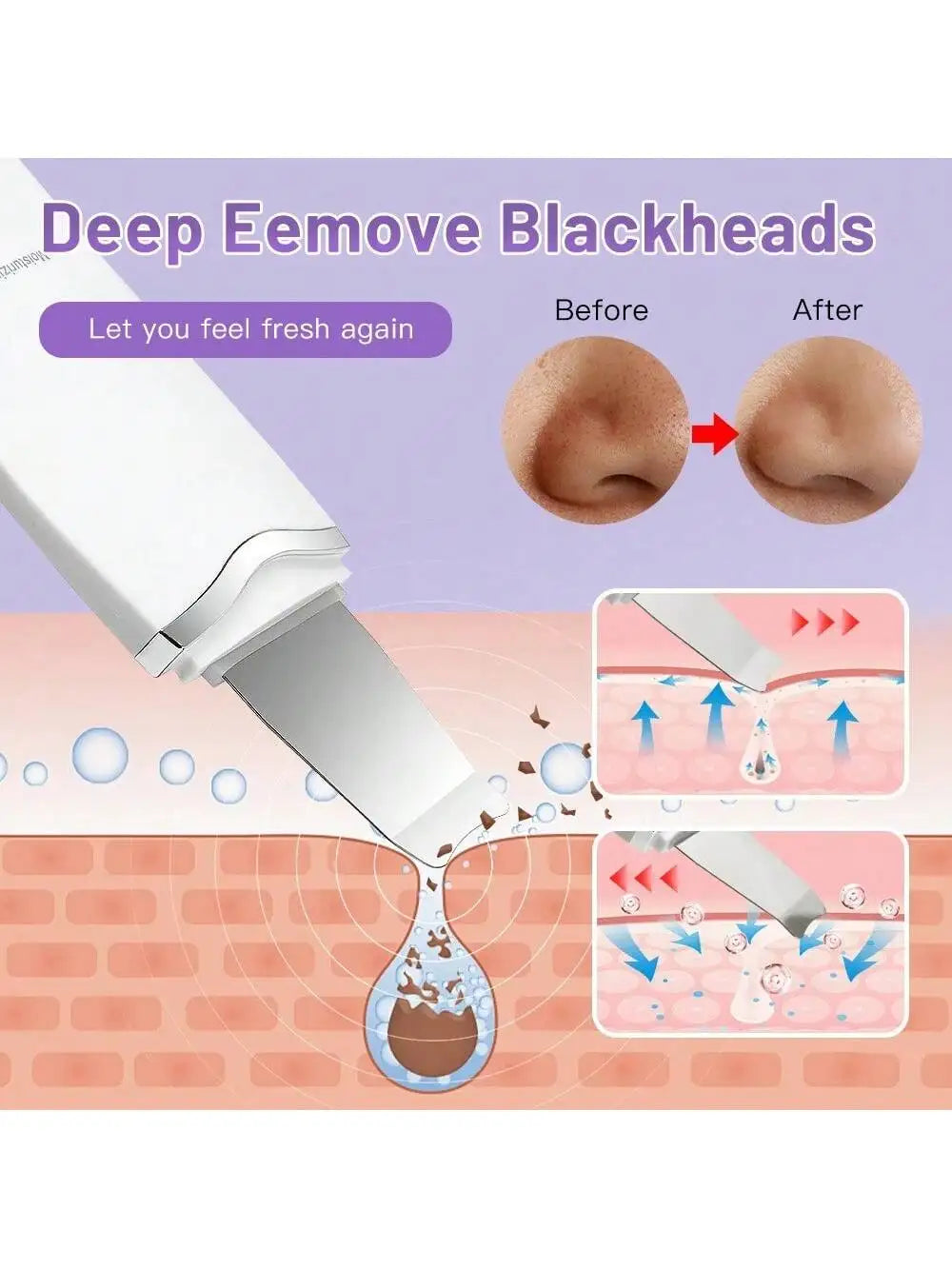 Ultrasonic Facial Scrubber